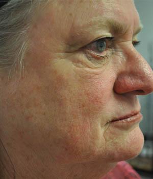 Maureen — before