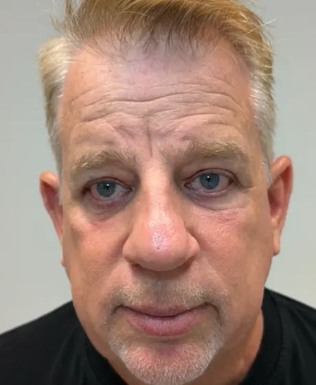 Scott — after